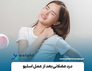 درد عضلانی بعد از عمل اسلیو