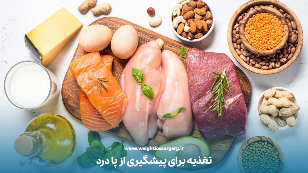 تغذیه مناسب برای پیشگیری از پا درد بعد از عمل اسلیو