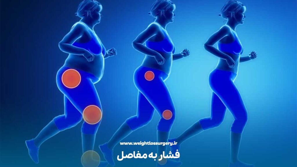 فشار به مفاصل