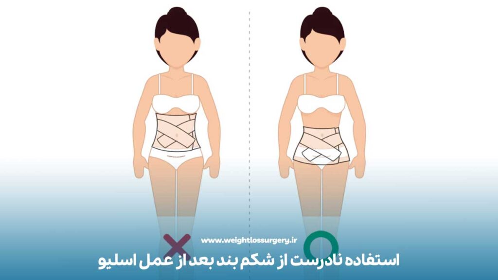 عوامل تشدید کننده درد عضلانی بعد از عمل اسلیو
